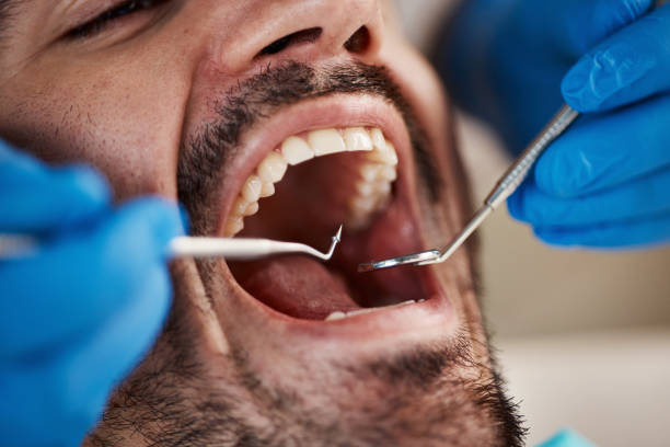 Best Emergency Treatment for Toothache in Leoti, KS
